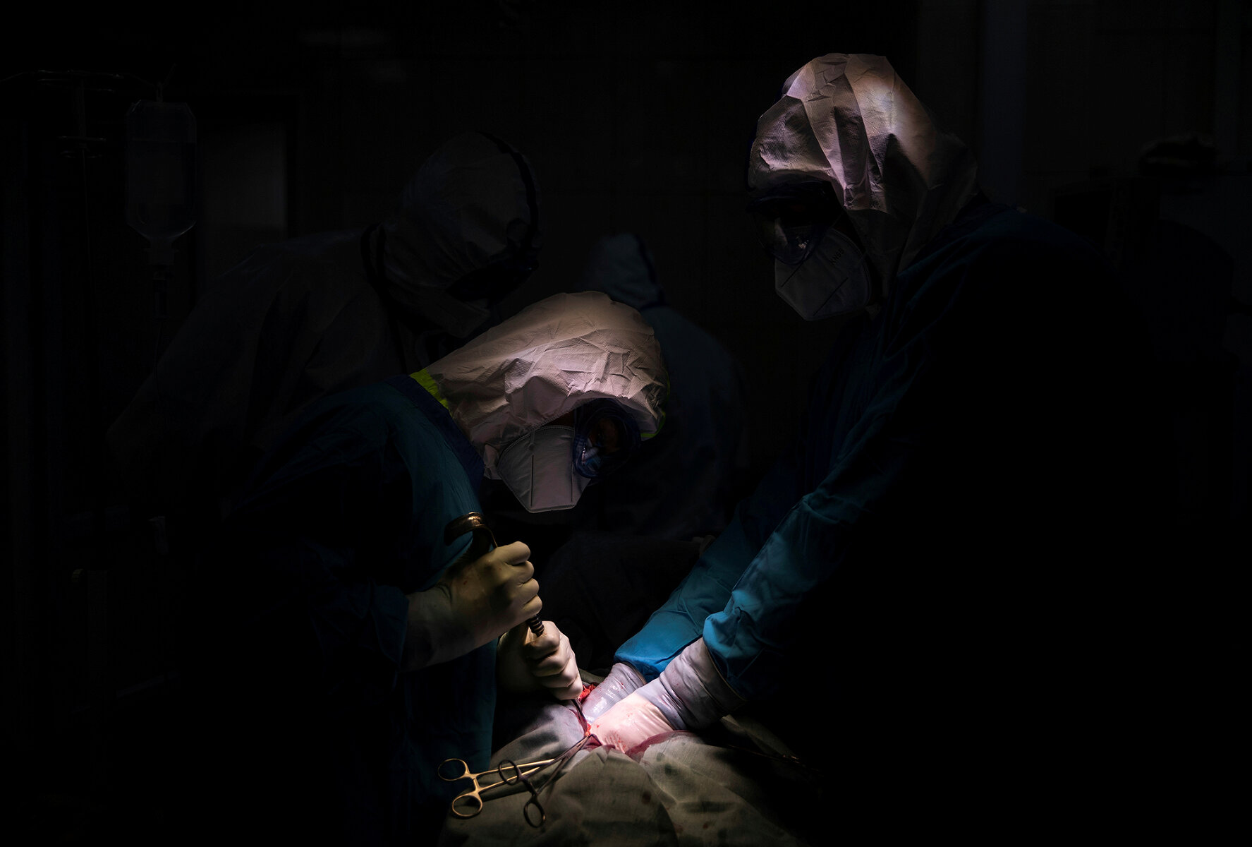 <p>Доктор Ислам Мурадов (справа) проводит экстренную операцию пациенту с COVID-19 в ГКБ №15 им. О.М. Филатова в Москве, Россия, 27 мая</p>
