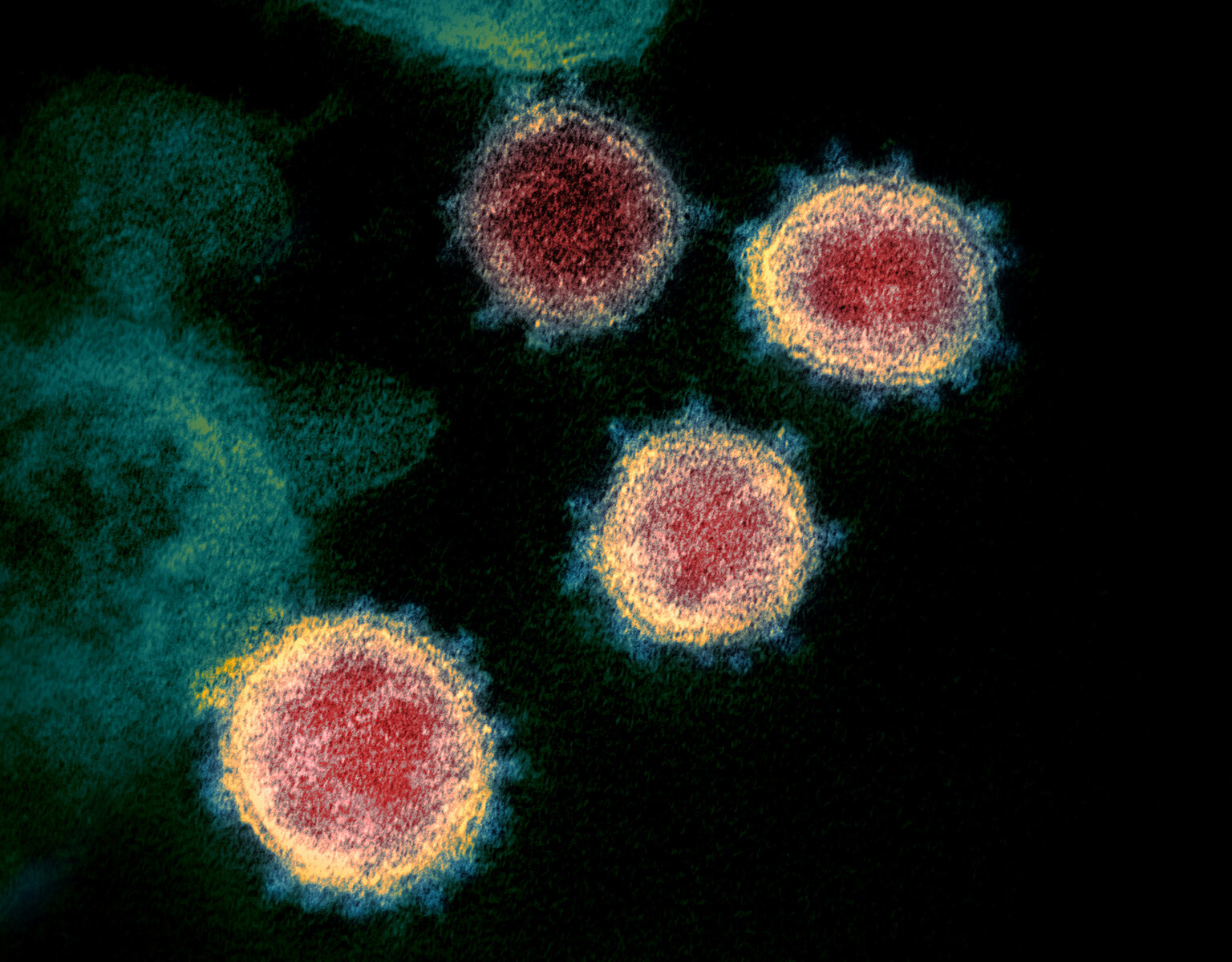 <p>Изображение коронавируса, полученное с помощью электронного микроскопа, 19 марта</p>